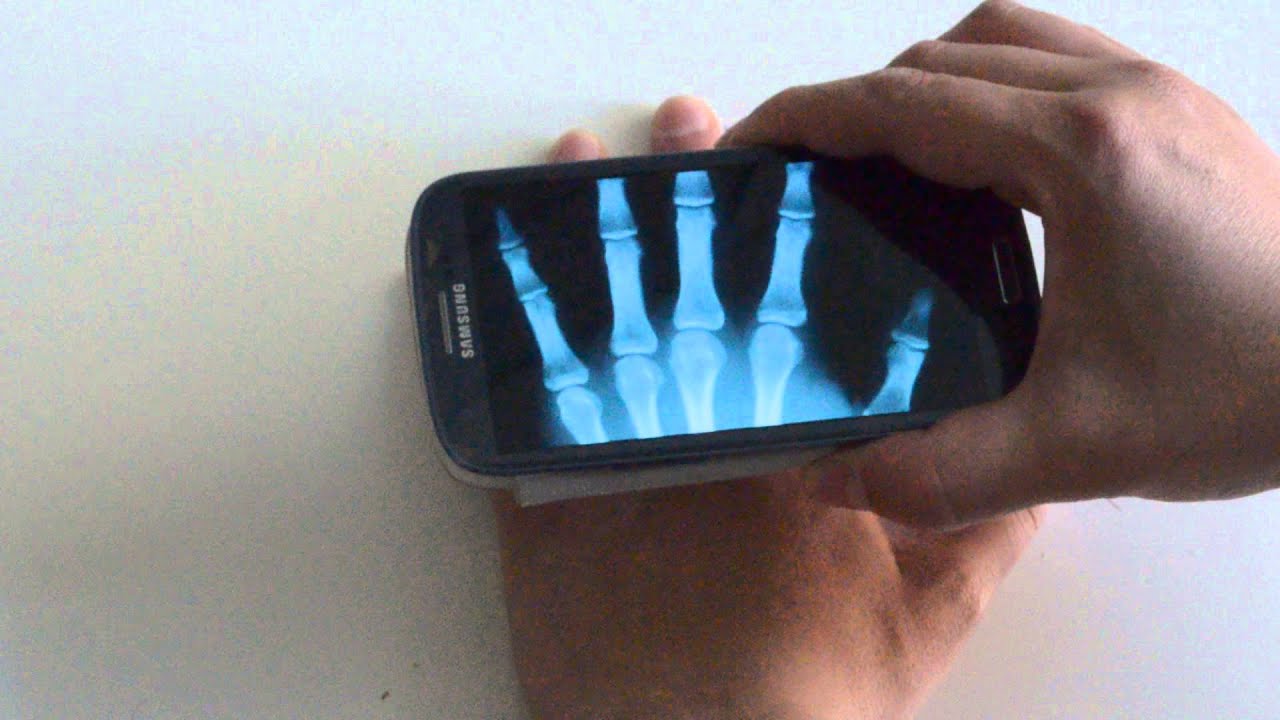 X Ray Mobile v2.0 App